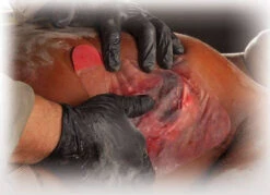 North American Rescue HyFin Chest Seal -Holsters Shop north american rescue hyfin chest seal 10 0015 71375.1683217980