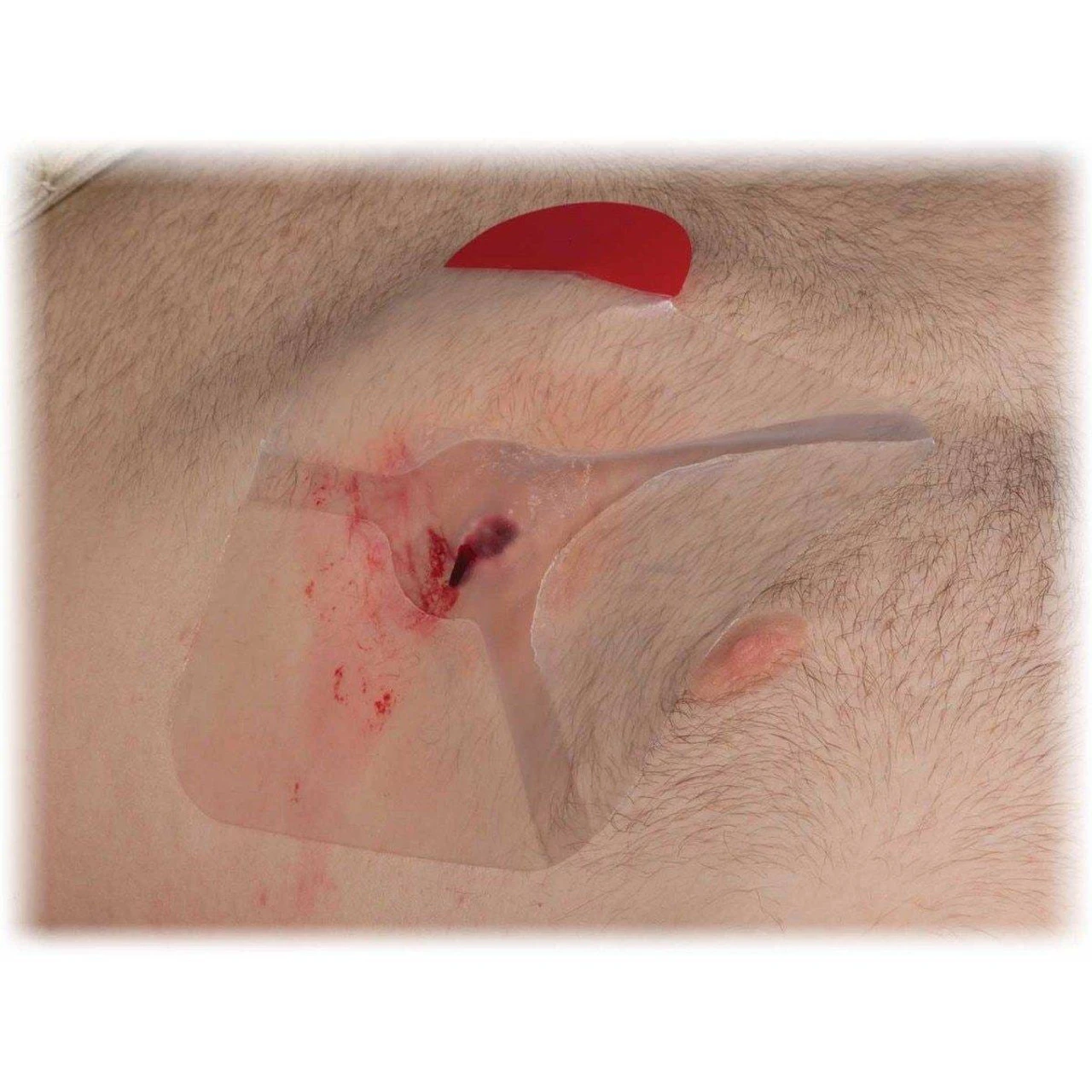 North American Rescue HyFin Chest Seal - Twin Pack 5 North American Rescue HyFin Chest Seal - Twin Pack - Image 3